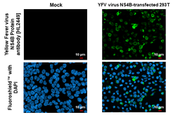 Anti-Yellow Fever virus NS4B Protein antibody [HL2449] used in Immunocytochemistry/ Immunofluorescence (ICC/IF). GTX638767
